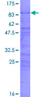 12.5% SDS-PAGE Stained with Coomassie Blue.